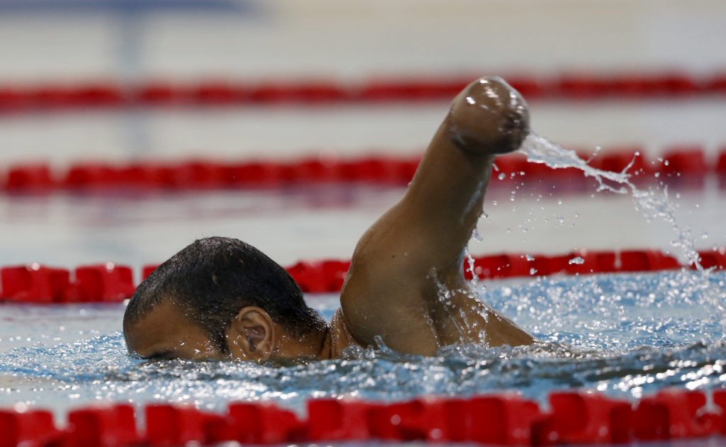 An athlete with an arm amputation swims